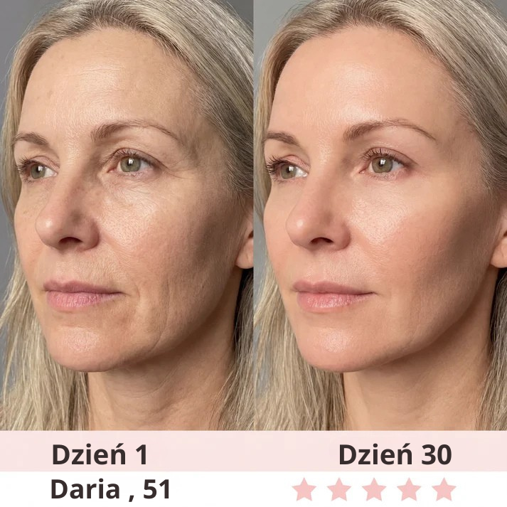 Lumi-Care urządzenie do liftingu skóry LED 7w1 - obrazek 6