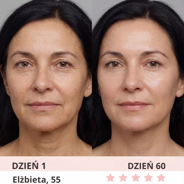 Lumi-Care urządzenie do liftingu skóry LED 7w1 - obrazek 7